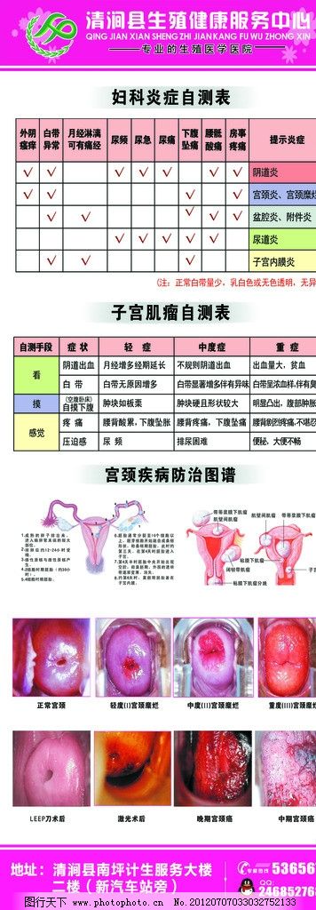 科X展架图片,生殖健康标志 妇科炎症自测表 子